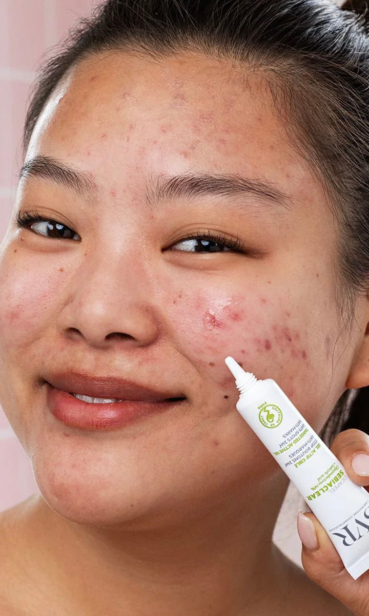 Cicapeel sebiaclear gel ultra concentrado SVR - SOS anti granos 🆘