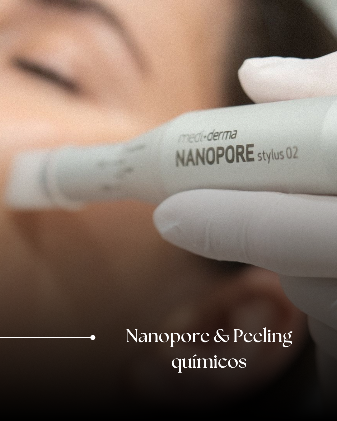 Tratamientos Medicina Estética & Antienvejecimiento