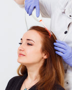 Mesoterapia Capilar